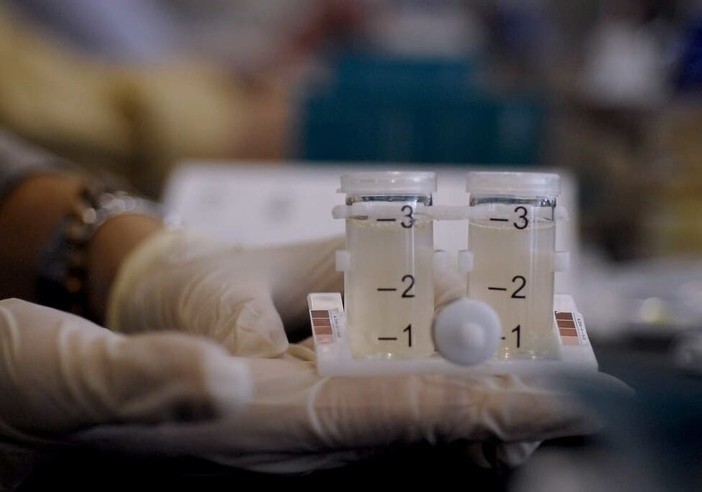 Cesano Boscone, casi di legionella in una scuola