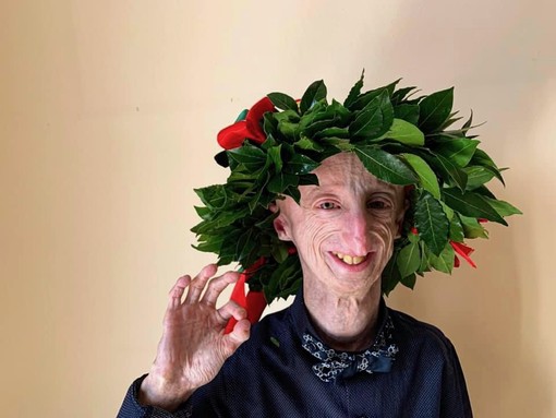 Addio a Sammy Basso, il 28enne italiano malato di Progeria: «Esempio di coraggio, fede e positività»