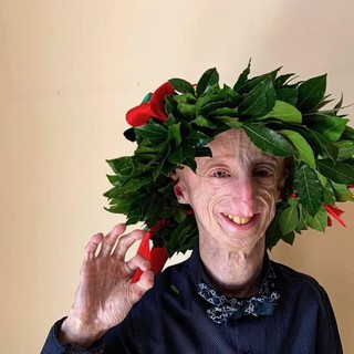 Addio a Sammy Basso, il 28enne italiano malato di Progeria: «Esempio di coraggio, fede e positività»